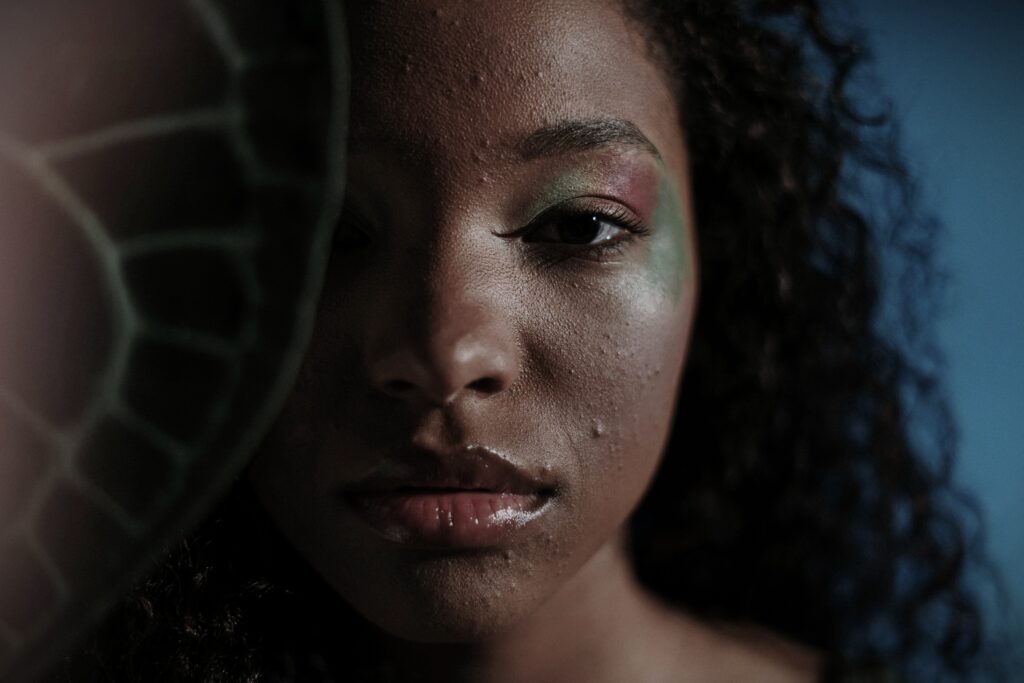 A young girl with acne, partially covering her face, showing the raw and emotional struggle with self-confidence and mental health.